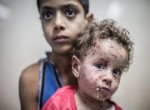 آمار کودکان آسیب دیده در جریان حملات اسرائیل به غزه موجب نگرانی مجامع بین المللی شده است (آژانس خبری اروپا)