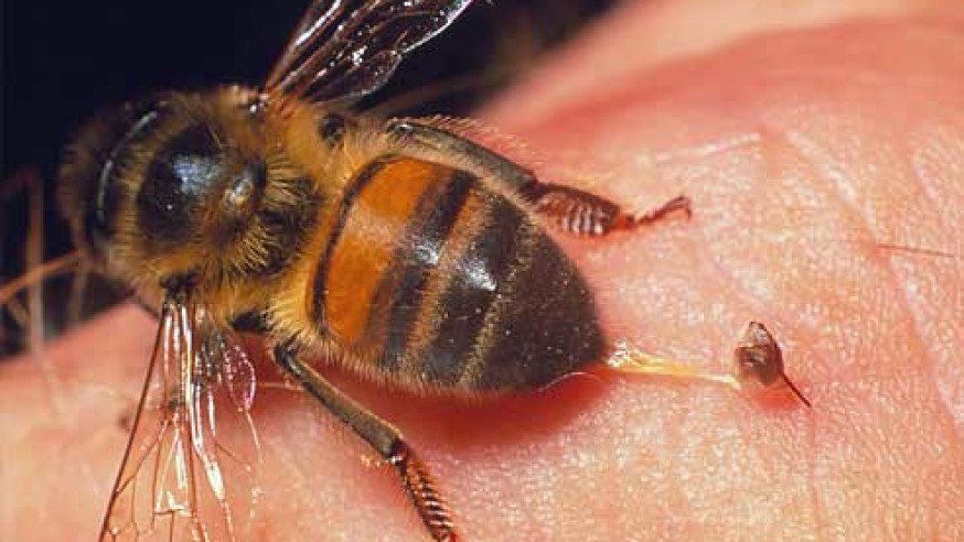 فوت دختر 19 ساله در ایران به خاطر نیش زنبور!