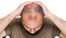 نسخه طب سنتی برای درمان ریزش مو چیست؟